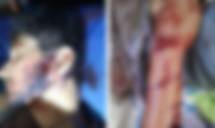 Imagem de compartilhamento para o artigo Trabalhador rural é atacado por onça-pintada e fica gravemente ferido no Pantanal da MS Todo dia